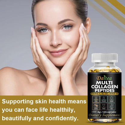 Multi Collagen Peptides, Type I, II, III and X, Hydrolyzed Collagen Peptides with Vitamin C, Supports Skin Hair Nail & Joint